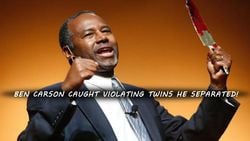 Ben Carson Caught Violating Twins He Separated